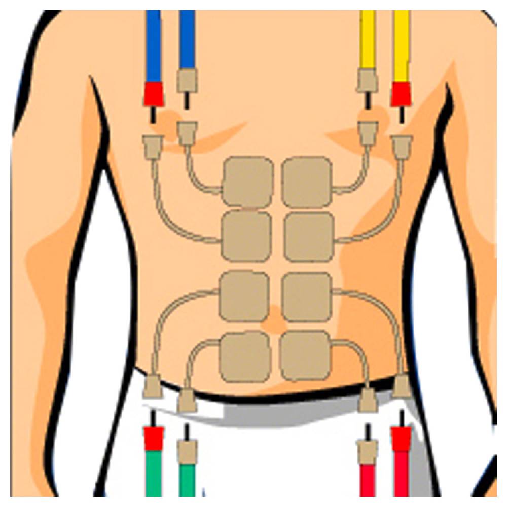 Sport Tec Compex Elektroden Wire, 5x5 cm, 4 Stück Speichern exportieren