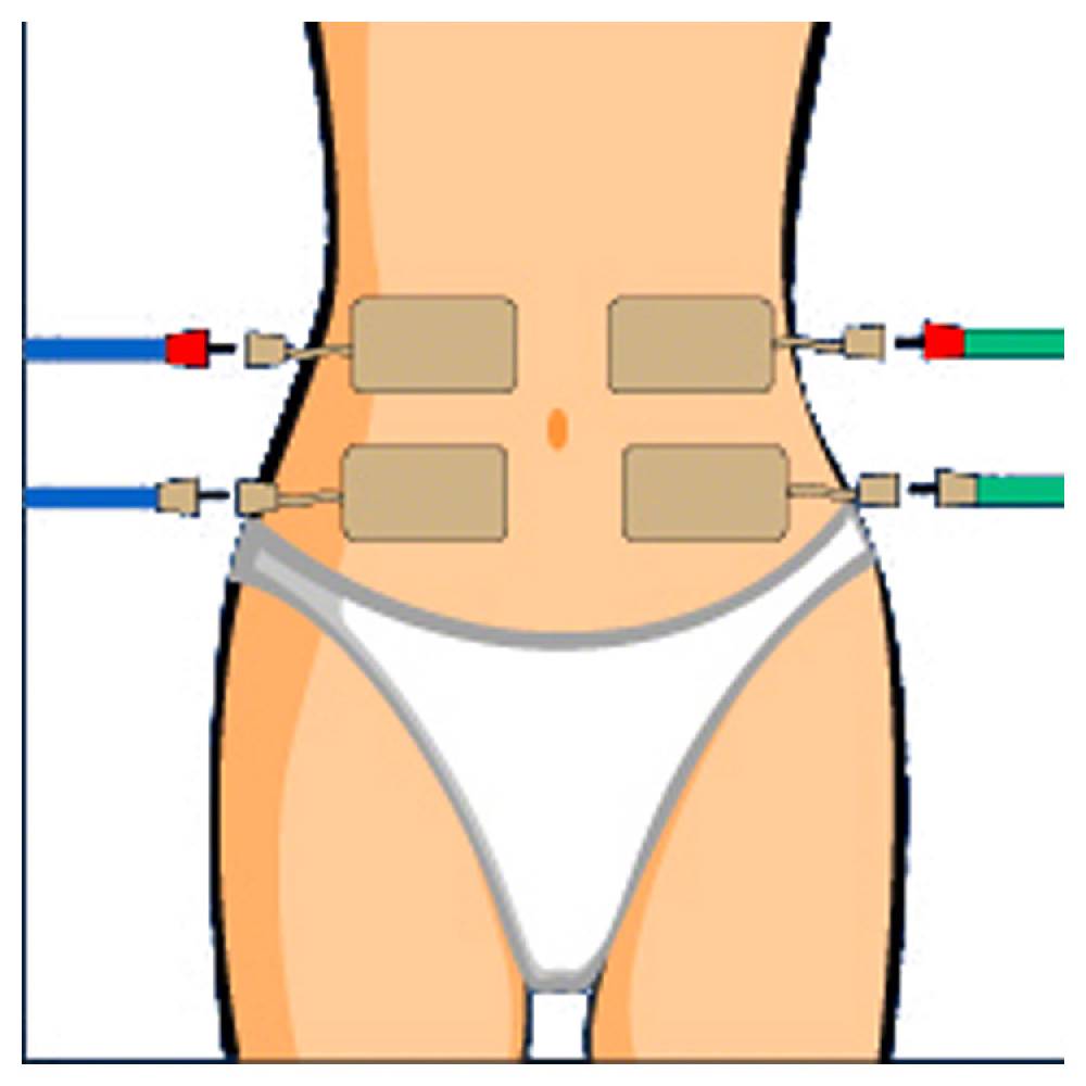 Sport Tec Compex Elektroden Wire, 5x10 cm, 2 Stück Black Friday Preise