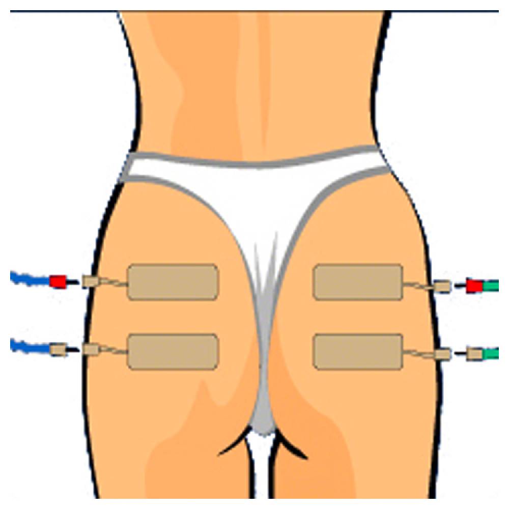 Sport Tec Compex Elektroden Wire, 5x10 cm, 2 Stück Black Friday Preise